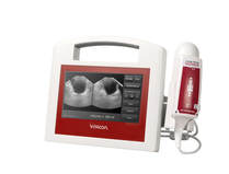 VitaScan LT Bladder Scanner with Antimicrobial (Medical Grade) Pole Cart